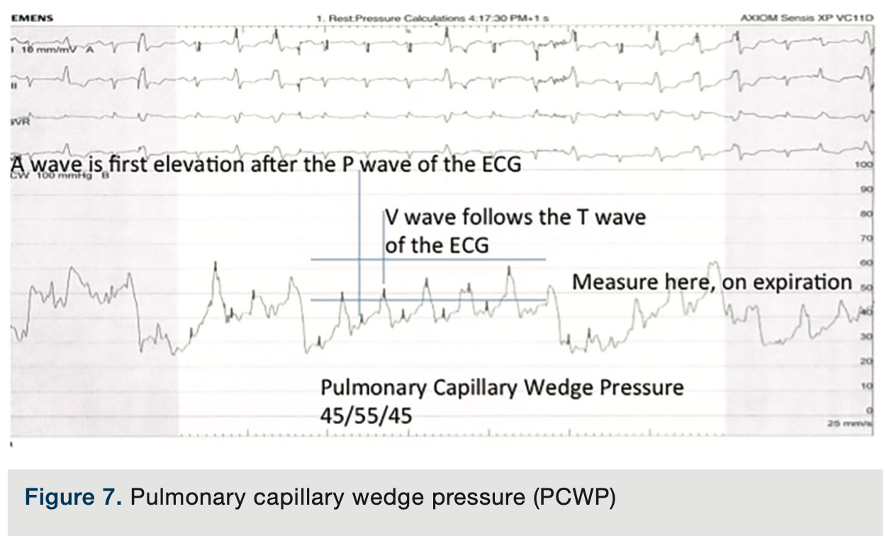 Test Your Hemodynamic Knowledge: Part II– The Answer Key